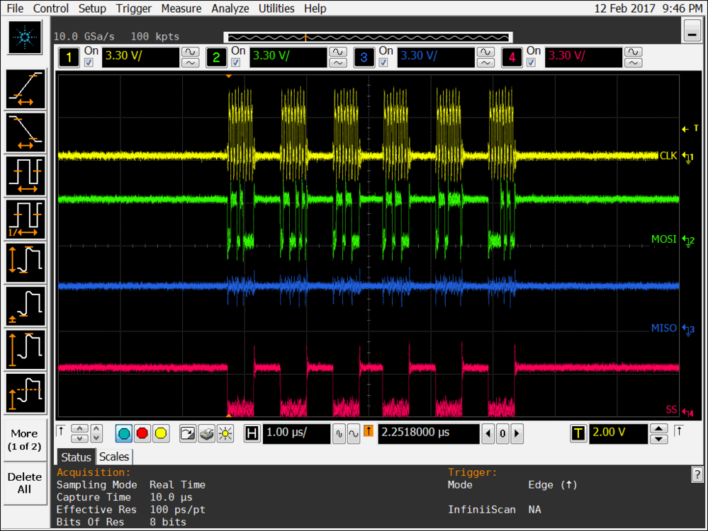 spi sspin.bmp